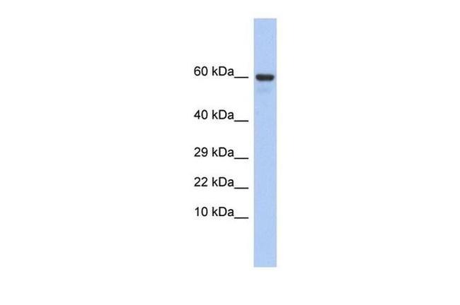 TXLNG Antibody in Western Blot (WB)