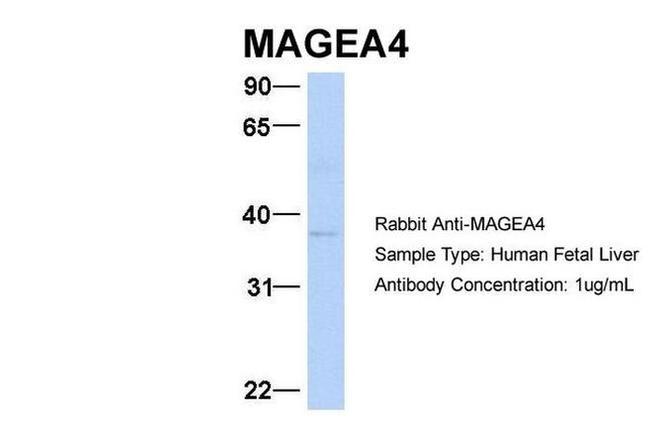 MAGEA4 Antibody in Western Blot (WB)