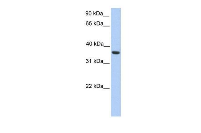 MAGEA4 Antibody in Western Blot (WB)