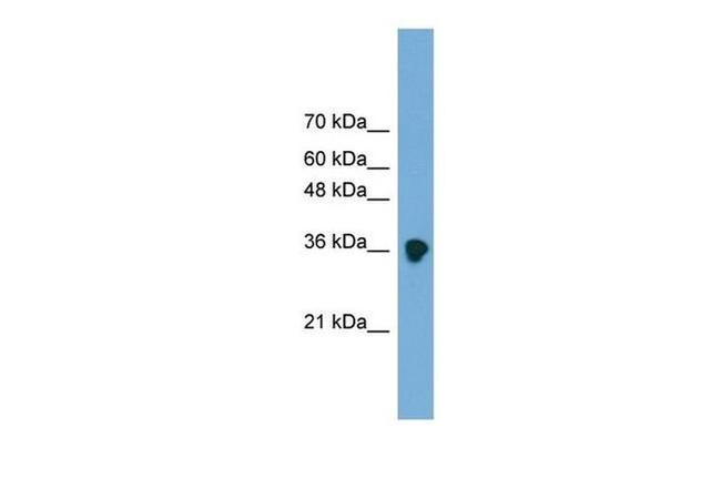 FRZB Antibody in Western Blot (WB)