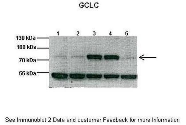 GCLC Antibody in Western Blot (WB)