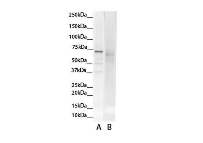 GCLC Antibody in Western Blot (WB)
