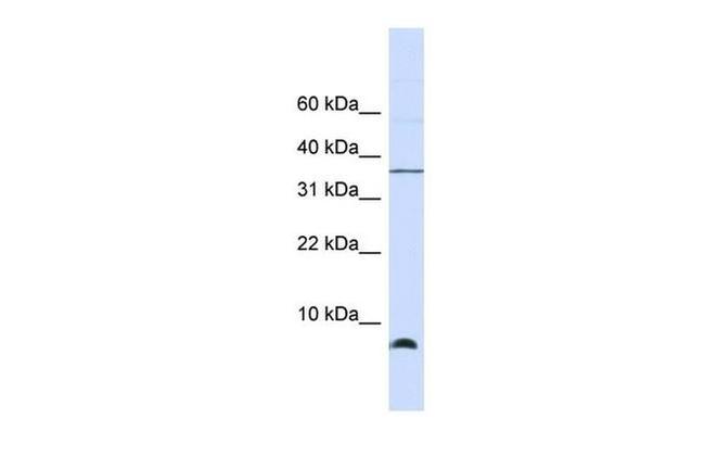 HSPE1 Antibody in Western Blot (WB)