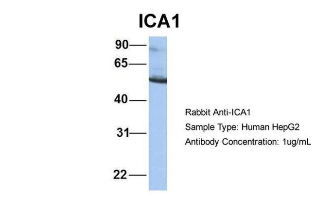 ICA1 Antibody in Western Blot (WB)