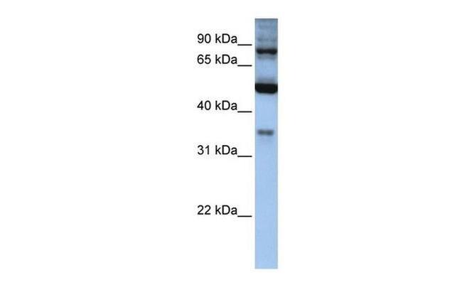 INPP5B Antibody in Western Blot (WB)