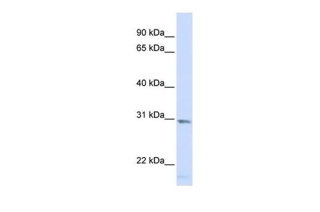 SMUG1 Antibody in Western Blot (WB)