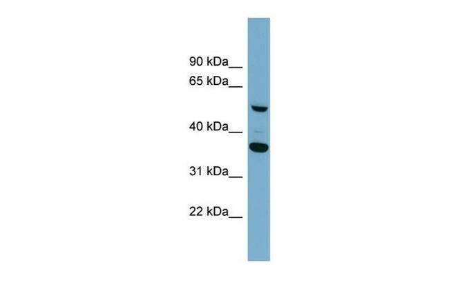 ADAMDEC1 Antibody in Western Blot (WB)