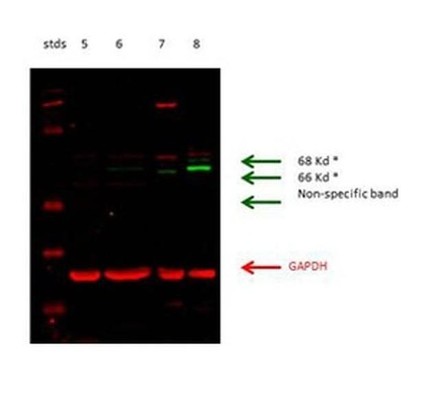 Glutaminase Antibody in Western Blot (WB)