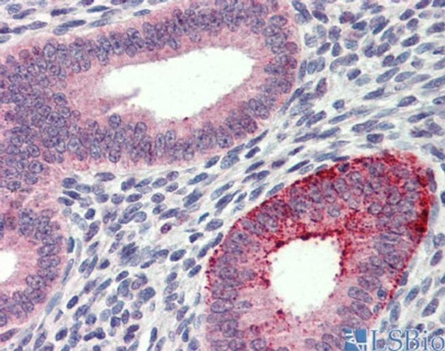 FCHO1 Antibody in Immunohistochemistry (IHC)