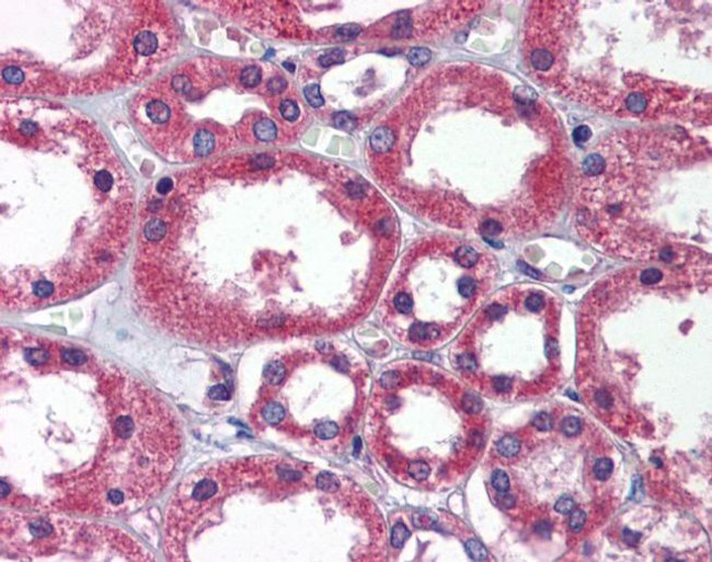 TBC1D1 Antibody in Immunohistochemistry (IHC)