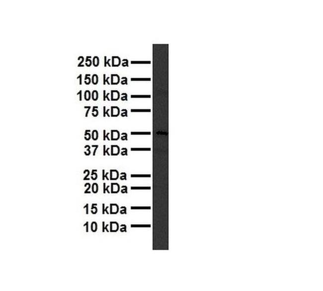 TBC1D1 Antibody in Western Blot (WB)