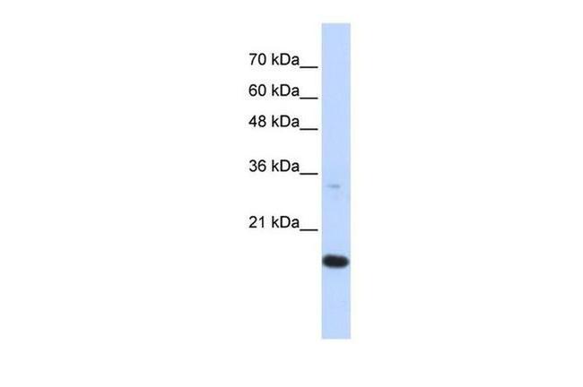 GABARAPL1 Antibody in Western Blot (WB)