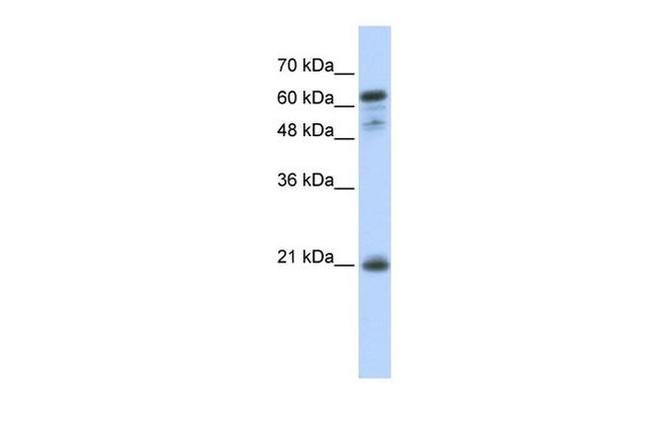 GCSAM Antibody in Western Blot (WB)