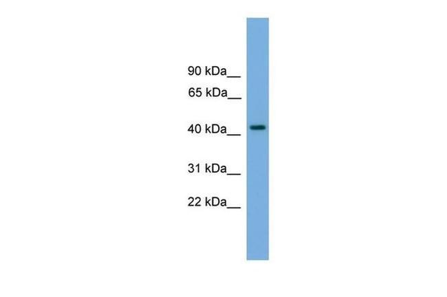 PALM Antibody in Western Blot (WB)