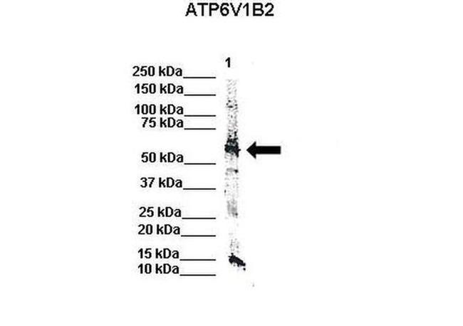 ATP6V1B2 Antibody in Western Blot (WB)