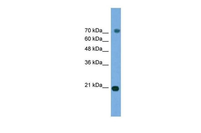 ERK3 Antibody in Western Blot (WB)