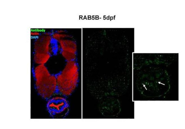 RAB5B Antibody in Immunohistochemistry (IHC)