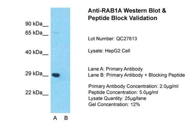 RAB1A Antibody in Western Blot (WB)