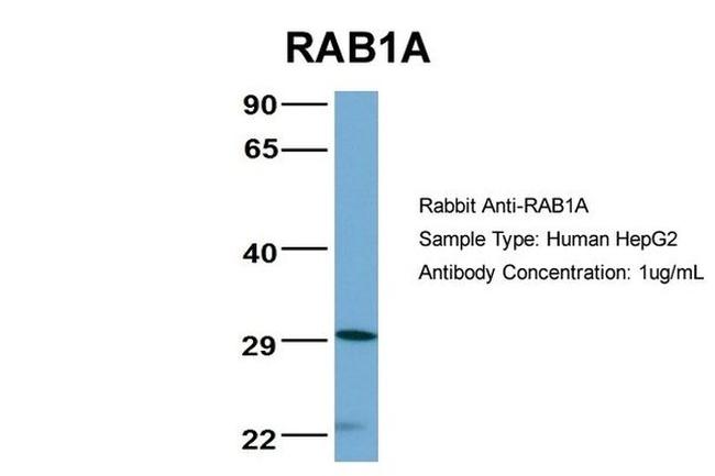 RAB1A Antibody in Western Blot (WB)