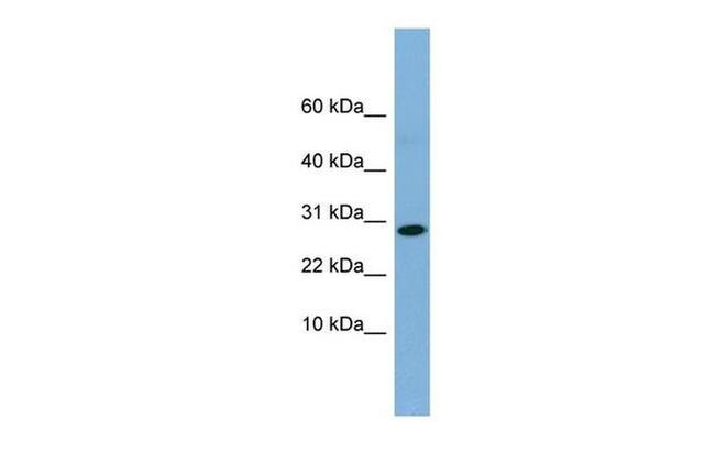 Ribulose-phosphate 3-epimerase Antibody in Western Blot (WB)