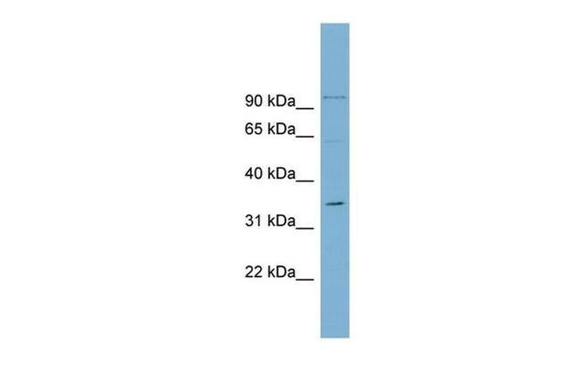 OTUB1 Antibody in Western Blot (WB)