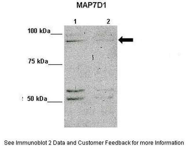 MAP7D1 Antibody in Western Blot (WB)