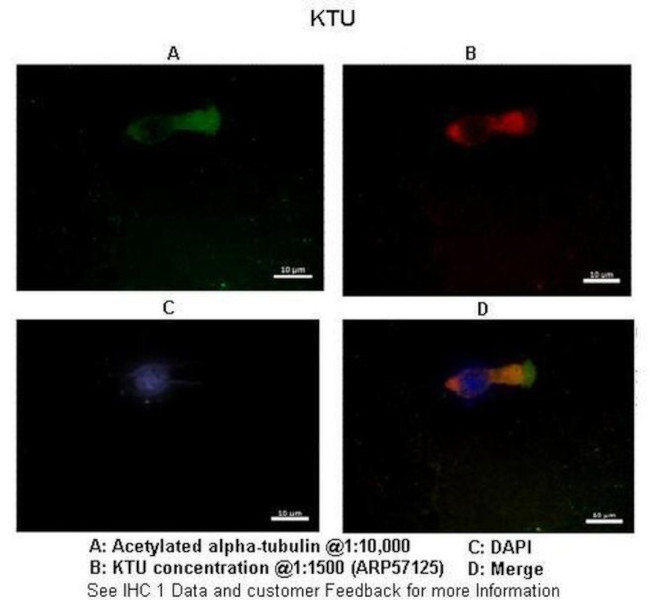 DNAAF2 Antibody in Immunocytochemistry (ICC/IF)