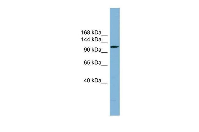 DNAAF2 Antibody in Western Blot (WB)