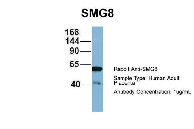 C17orf71 Antibody in Western Blot (WB)