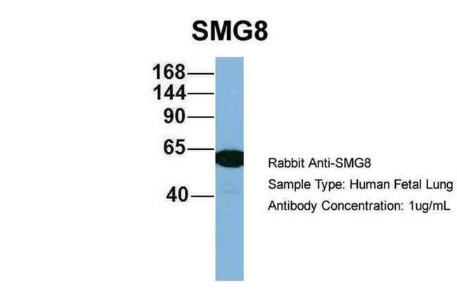 C17orf71 Antibody in Western Blot (WB)