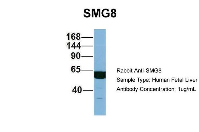 C17orf71 Antibody in Western Blot (WB)