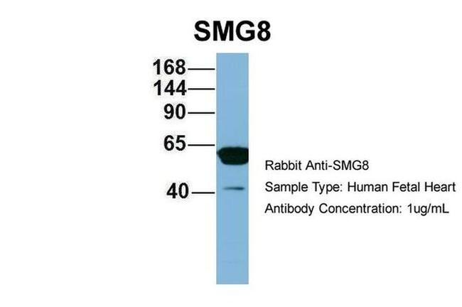 C17orf71 Antibody in Western Blot (WB)