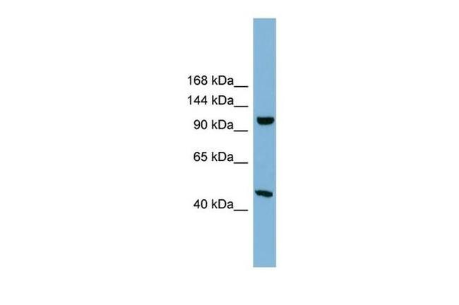 C17orf71 Antibody in Western Blot (WB)