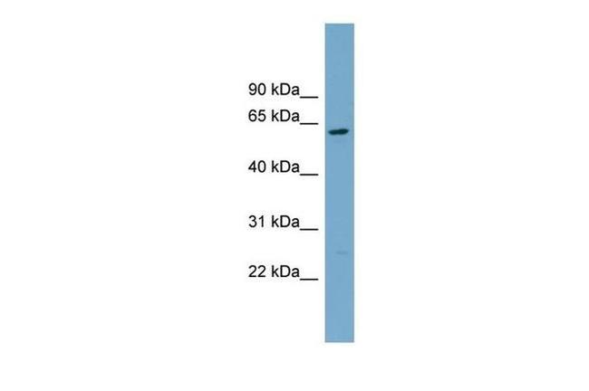 CNDP2 Antibody in Western Blot (WB)