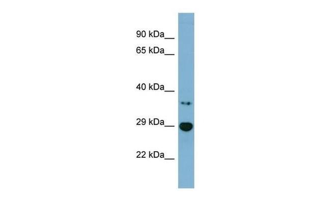 BDH2 Antibody in Western Blot (WB)