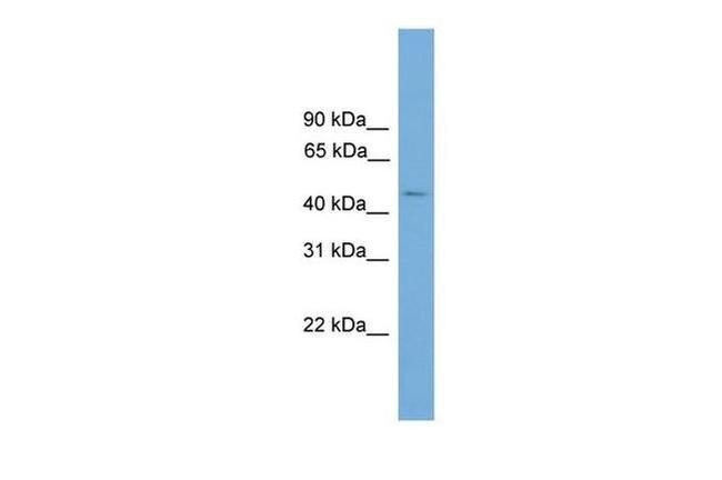 C11orf16 Antibody in Western Blot (WB)