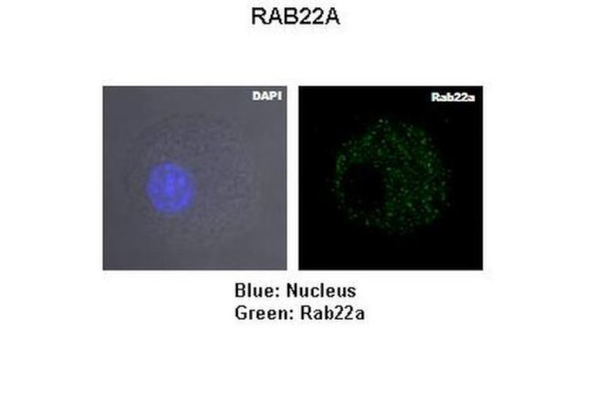 RAB22A Antibody in Immunocytochemistry (ICC/IF)