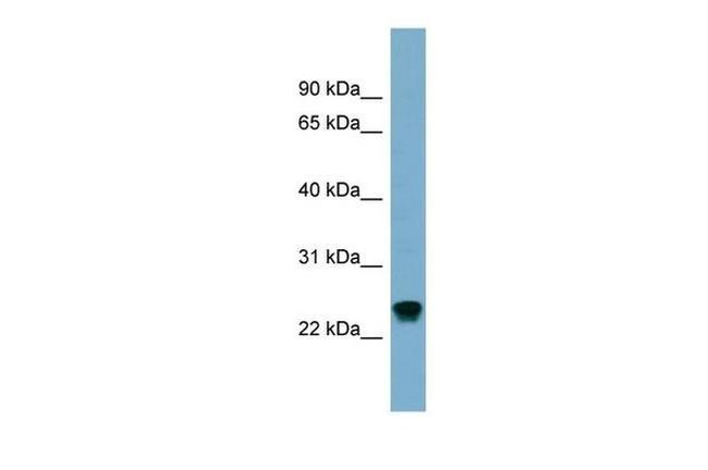 RAB22A Antibody in Western Blot (WB)