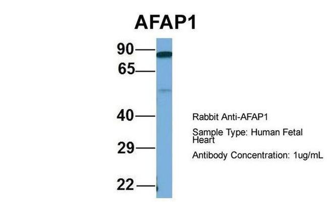 AFAP Antibody in Western Blot (WB)