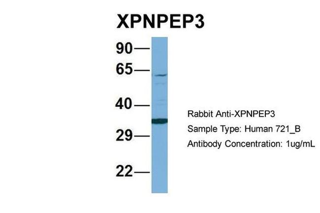 XPNPEP3 Antibody in Western Blot (WB)