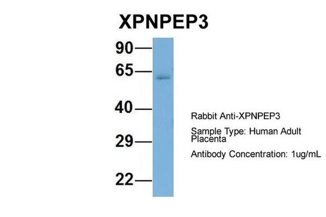 XPNPEP3 Antibody in Western Blot (WB)