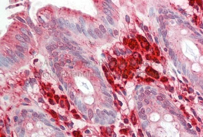 RAC1 Antibody in Immunohistochemistry (Paraffin) (IHC (P))