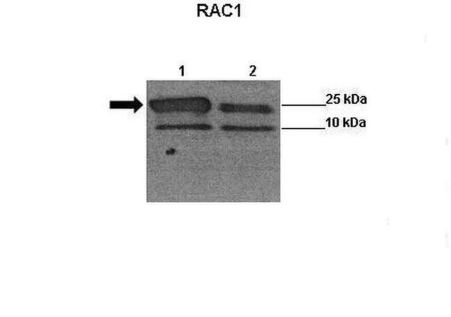 RAC1 Antibody in Western Blot (WB)