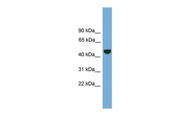 PSMD12 Antibody in Western Blot (WB)