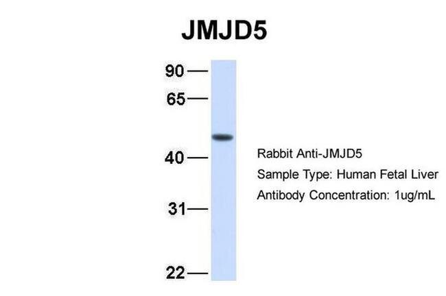 JMJD5 Antibody in Western Blot (WB)