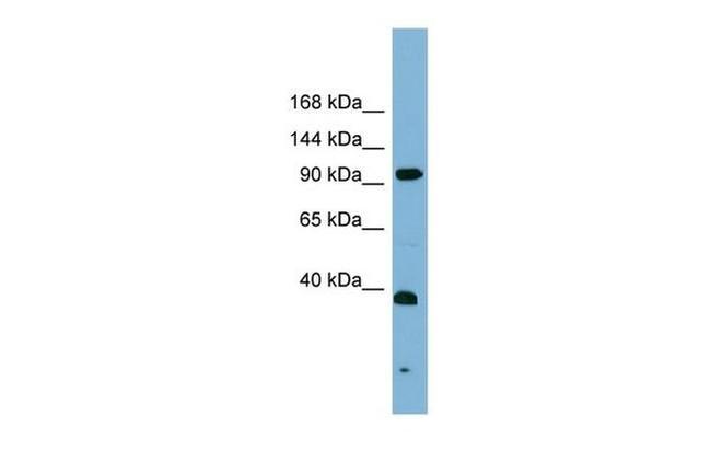 XPF Antibody in Western Blot (WB)