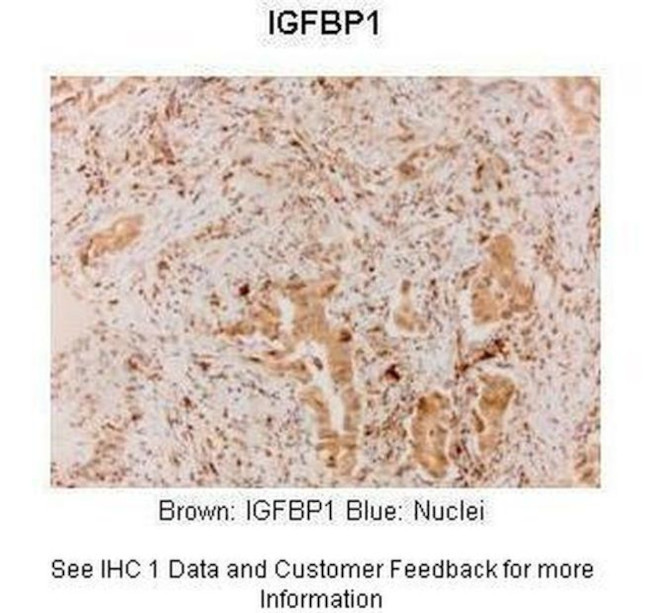 IGF2BP1 Antibody in Immunohistochemistry (IHC)