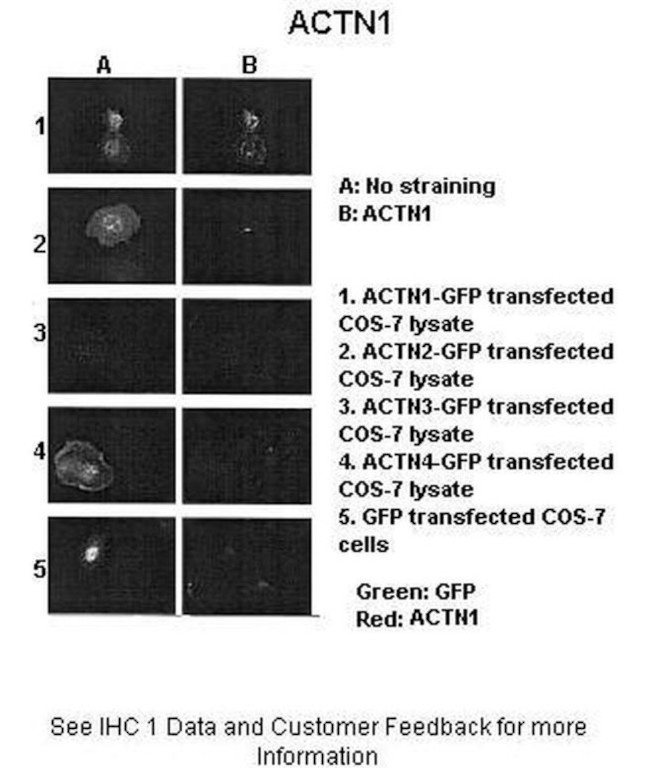 alpha Actinin 1 Antibody in Immunohistochemistry (IHC)