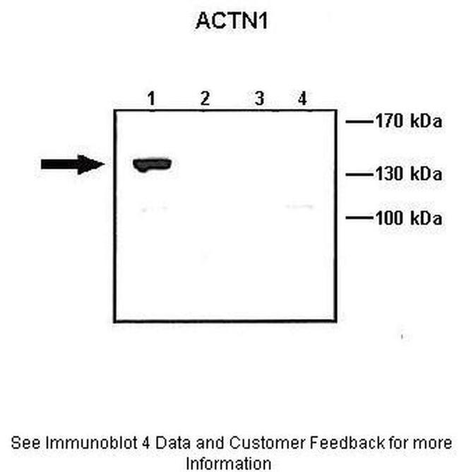 alpha Actinin 1 Antibody in Western Blot (WB)