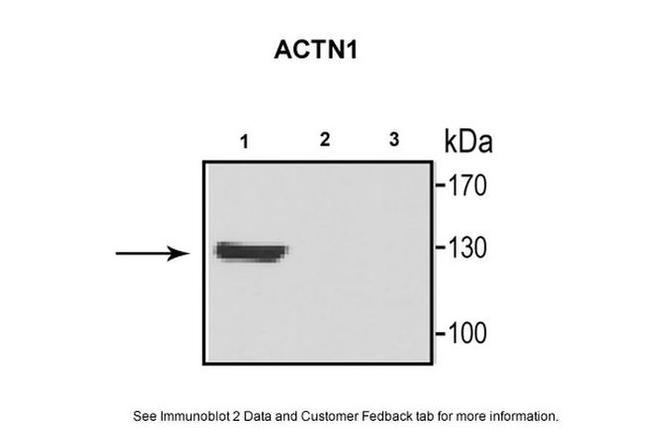 alpha Actinin 1 Antibody in Western Blot (WB)